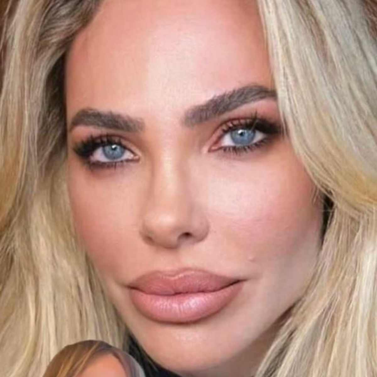 Ilary Blasi ritocchi chirurgia estetica
