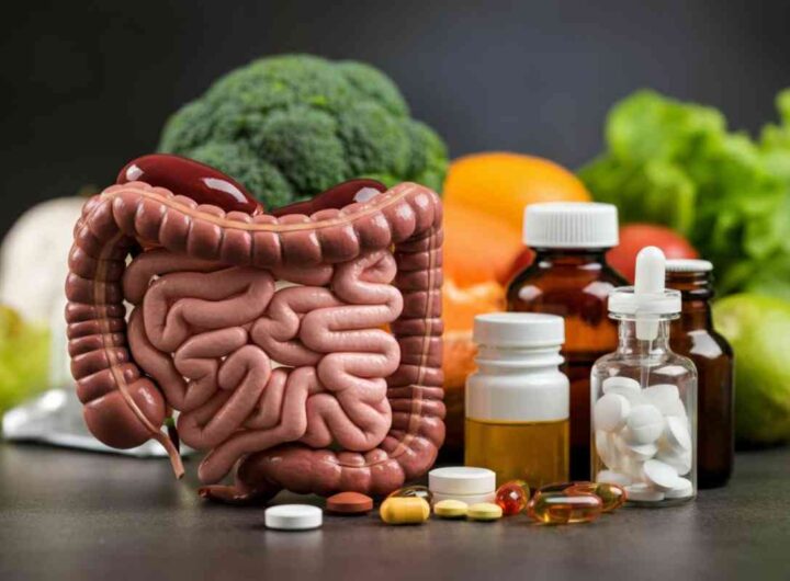 l'alimento che fa bene all'intestino